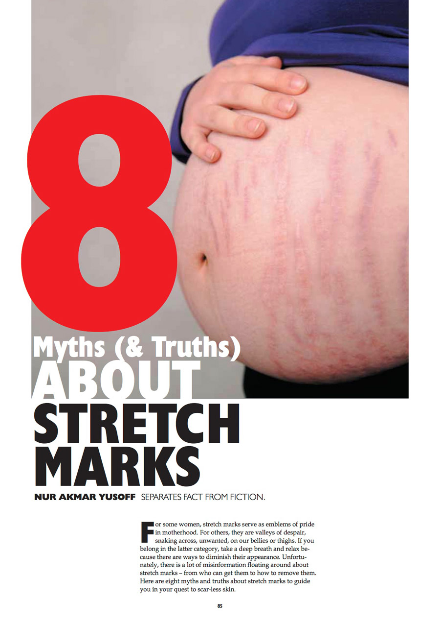 8 myths about stretch marks, Cosmetic Surgery & Beauty, Issue 1, 2012