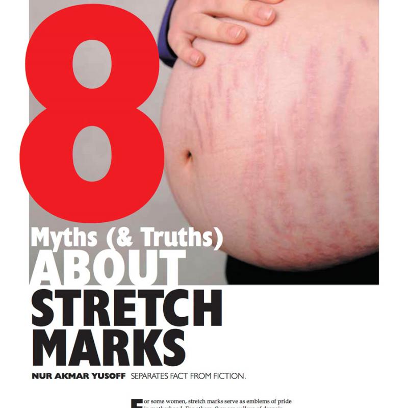 8 myths about stretch marks, Cosmetic Surgery & Beauty, Issue 1, 2012